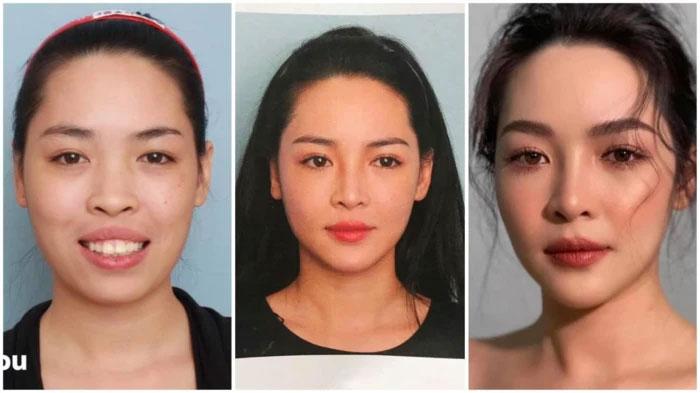 Hot Girl Nam Định Gây SỐC khi ngoại hình 'Lột Xác' sau Phẫu Thuật Thẩm Mỹ