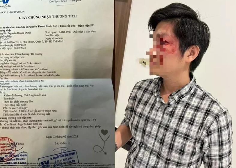 Thả Rông Chó Không Rọ Mõm, Còn ĐÁNH Người Khác Dã Man